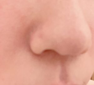 クレンジング後の毛穴